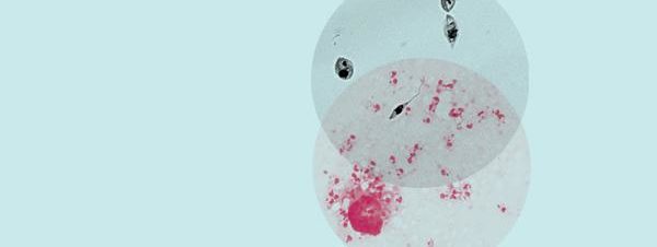 ‘Interruption’ at Townhouse Gallery