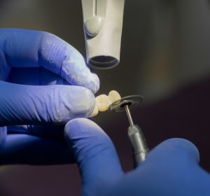 تجربتي مع عيادة الماسة للأسنان في الجيزة: احترافية ونظافة وأسعار مناسبة