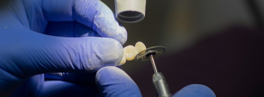 تجربتي مع عيادة الماسة للأسنان في الجيزة: احترافية ونظافة وأسعار مناسبة